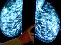 More than 10,000 Herefordshire women miss “vital” cancer screenings